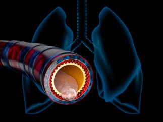 The Stages of a Cold - Mucus in respiratory system